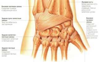 Растяжение связок лучезапястного сустава: причины, симптоматика и лечение патологии