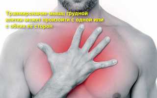 Все методы лечения растяжения грудных мышц