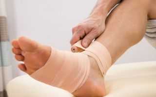 Травмы суставов: растяжения и вывихи